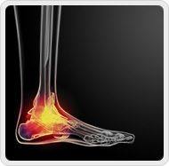 Ankle