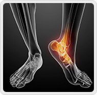 Foot